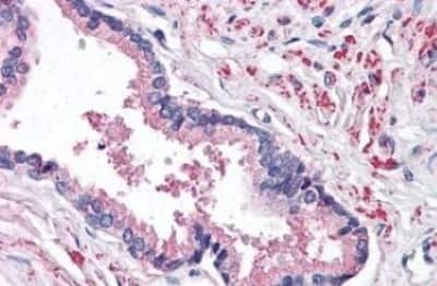 Immunohistochemistry-Paraffin: STEAP2 Antibody [NBP3-14487] - STEAP2 antibody IHC of human prostate. Immunohistochemistry of formalin-fixed, paraffin-embedded tissue after heat-induced antigen retrieval.